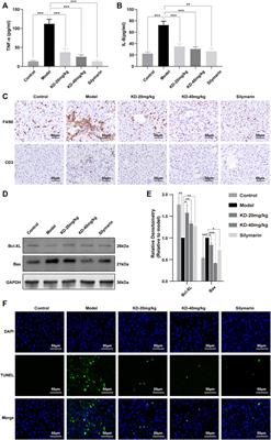 Kinsenoside Alleviates Alcoholic Liver Injury by Reducing Oxidative Stress, Inhibiting Endoplasmic Reticulum Stress, and Regulating AMPK-Dependent Autophagy